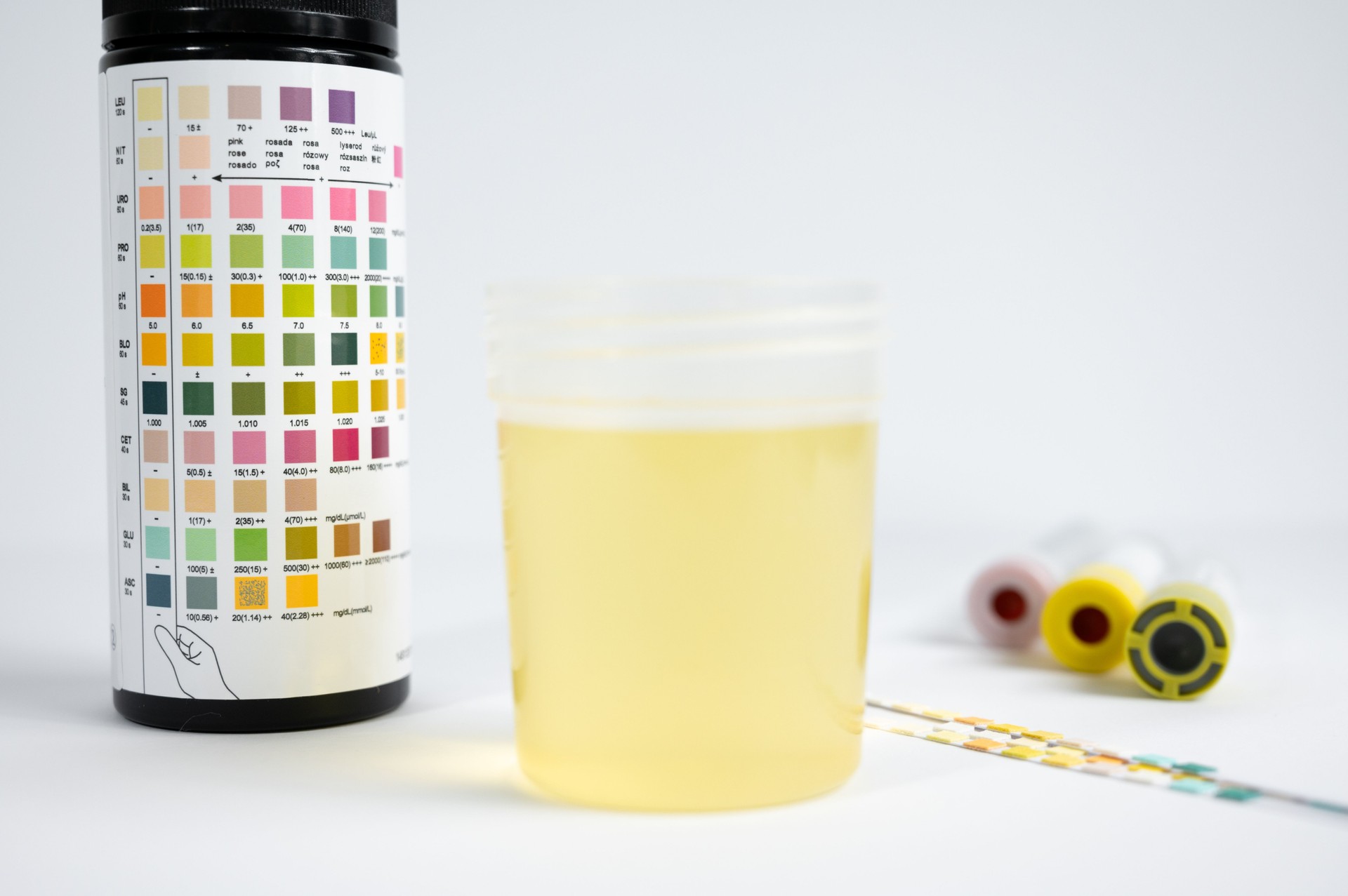 Urine sample being analyzed with test strips and color chart